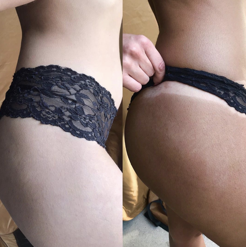 Before and after Sunescape spray tan - hip