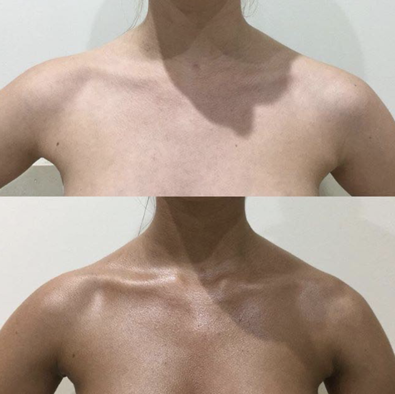 Before and after chest side view tanning result